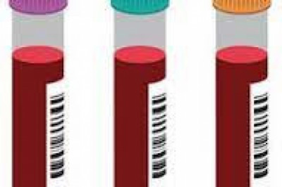 Blood Collection Tubes Market 2022 Size, Dynamics & Forecast Report to 2028