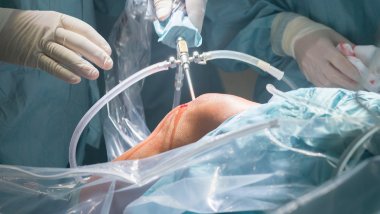 Knee Replacement Surgeon in Utah