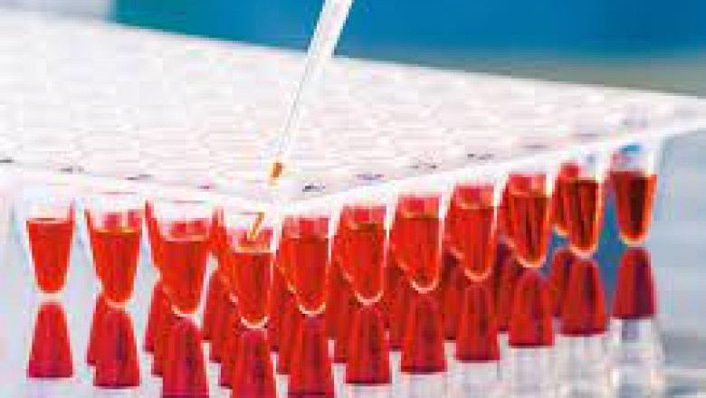 Polymerase Chain Reaction Market Size, Share, Regional Overview and Global Forecast to 2028
