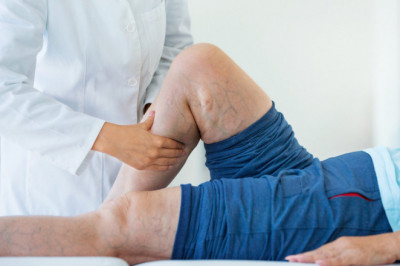 Global Varicose Vein Treatment Market Restraints