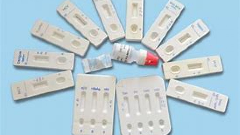 HIV/HBV/HCV Test Kits Market Analysis, Size, Share, Growth and Trends Report To 2028