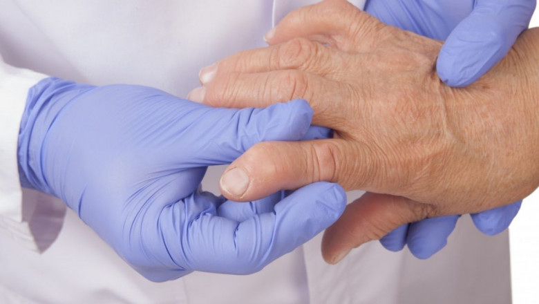 Rheumatoid Arthritis Treatment Aids to Relieve Symptoms and Improve Joint Function