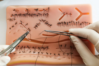 Sutures Are Used To Stitch Together Deep Wounds Or Cuts