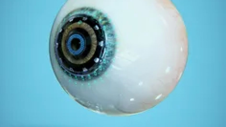 An Artificial Retina system restores partial vision to patients with retinal diseases, such as retinitis pigmentosa
