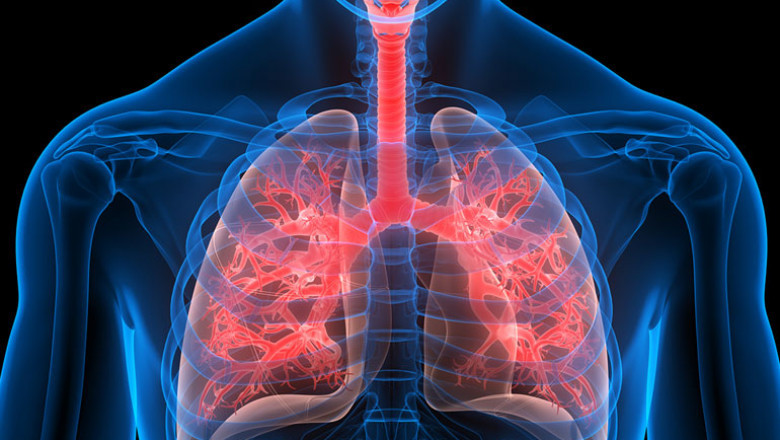 Global Infectious Respiratory Disease Diagnostics Market Report, Latest Trends, Industry Opportunity &amp; Forecast to 2028