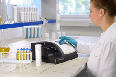 Urinalysis Market Growth May Be Hindered By High Costs Associated With Advanced Analyzers