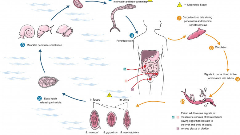 An Effective Schistosomiasis Treatment Is Praziquantel, A Medication That Kills The Worms Quickly