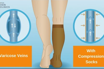 Benefits of Vein Compression Socks