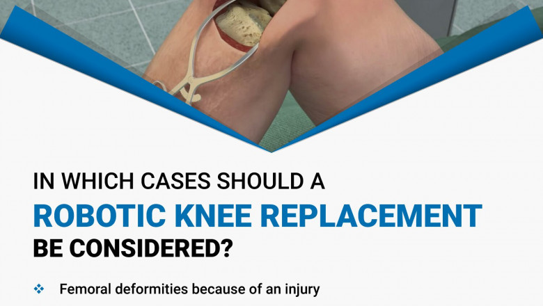 When robotic knee replacement is considered?