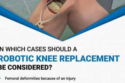 When robotic knee replacement is considered?