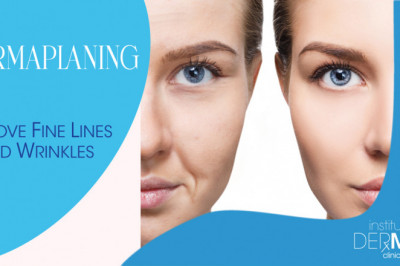 4 Ways Dermaplaning Can Improve Your Skin This Holiday Season