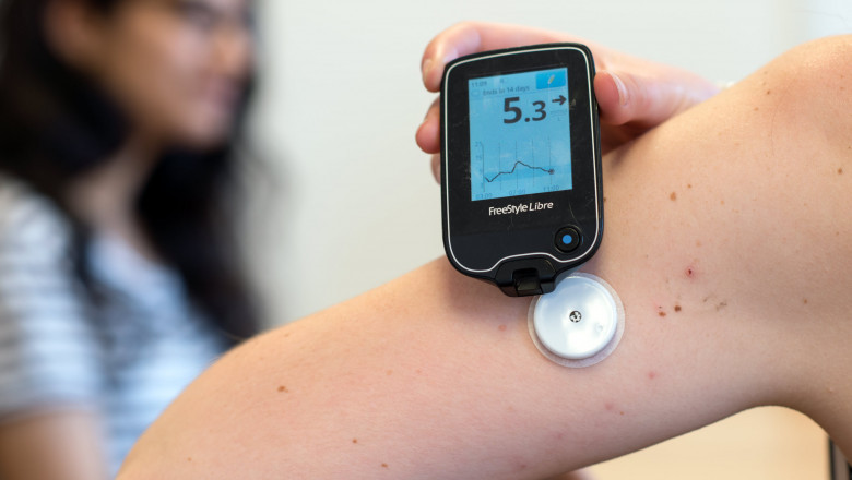 Things to know About Continuous Glucose Monitoring (CGM) Devices