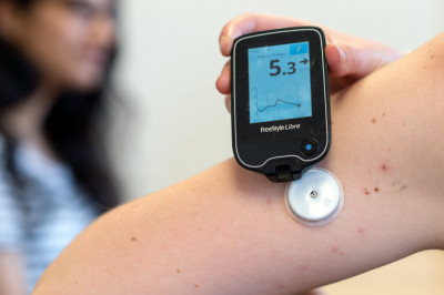 Things to know About Continuous Glucose Monitoring (CGM) Devices