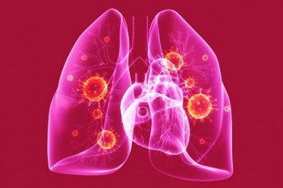 There is one strain of bacterium most commonly found in Pneumonia Testing, Streptococcus Pneumonia Testing.