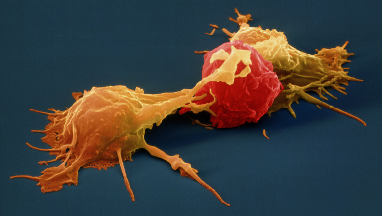 Cancerous and Virus-Infected Cells Are Recognized and Attacked By Natural Killer Cells