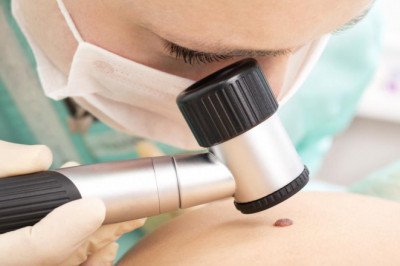 Melanoma Treatment Market Emerging Trend, Top Companies, Company Demand, Business Review and Regional Analysis by 2026