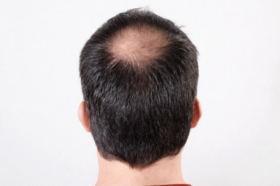 Platelet-Rich Plasma (PRP) Injections