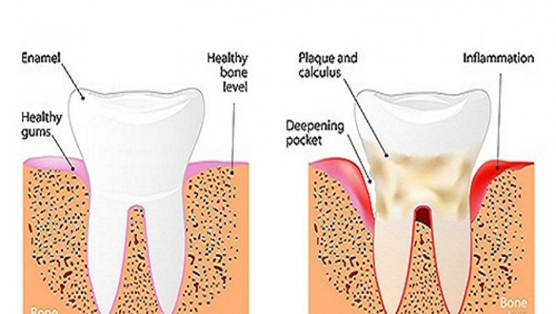 What Common problems can occur after dental implant surgery?