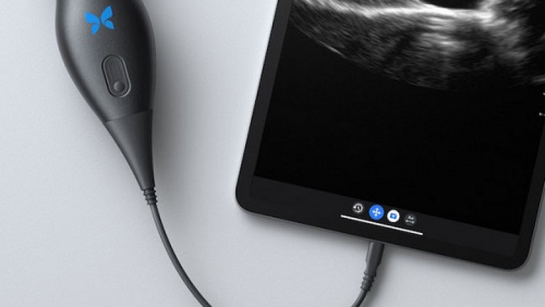 A global study of the portable diagnostic device market, including its share, size, growth, opportunity, and forecast for 2022-2028
