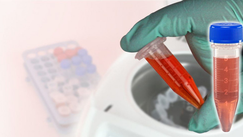 Global Blood Collection Tubes Market Players