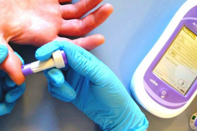 Global HIV Diagnostics Test Market Overview