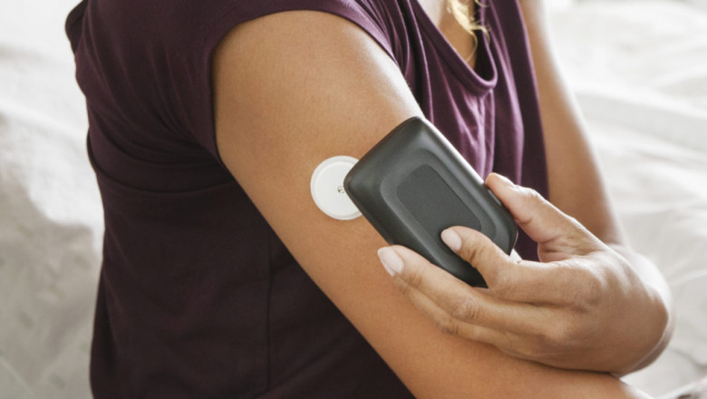 Market Analysis of Continuous Glucose Monitoring (CGM) Devices Market: Global Industry Trends, Share, Size, Growth, Opportunity, and Forecast 2022-2030