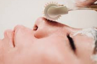 Vampire Facial Treatment in San Diego