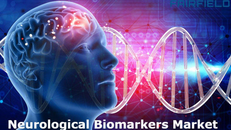 Neurological Biomarkers Market Insights, Growth and Investment Feasibility By 2029