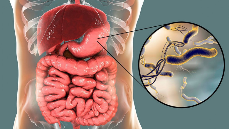 Helicobacter Pylori Diagnostics Market Size, Shares, Trends, and Forecasts to 2026