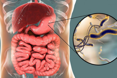 Helicobacter Pylori Diagnostics Market Size, Shares, Trends, and Forecasts to 2026