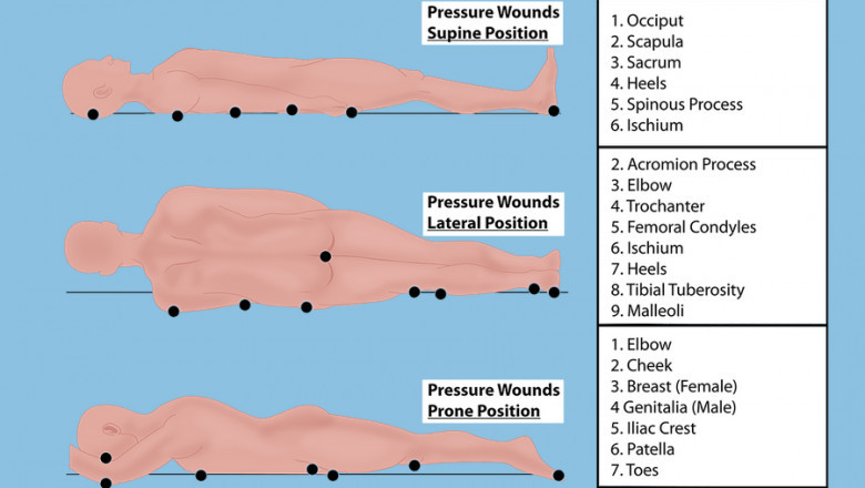 Topical hyperbaric oxygen therapy for the best wound recovery