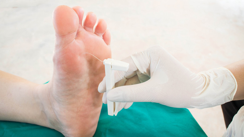 A Diabetic Foot Ulcer Treatment, Reduces The Risk Of Infection And Amputation