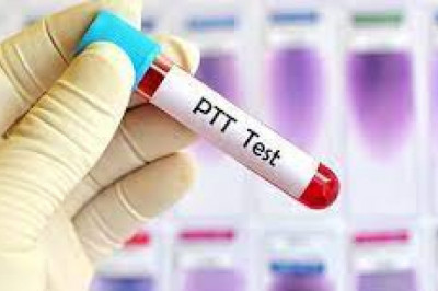 Activated Partial Thromboplastin Test Market Size, Share, Growth, Opportunities and Global Forecast to 2028