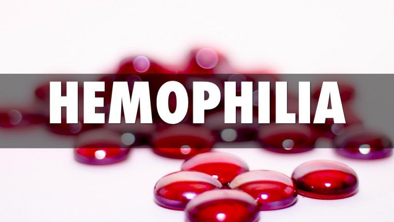 An analysis of the global Hemophilia Treatment Market in 2019-2027, including trends, shares, sizes, growth, opportunities, and forecasts