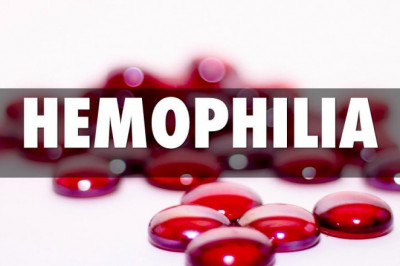 An analysis of the global Hemophilia Treatment Market in 2019-2027, including trends, shares, sizes, growth, opportunities, and forecasts