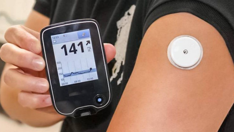 Glucose Sensor Take Less Time Than Standard Laboratory Glucose Testing Procedures