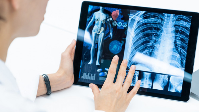Latest Trends of Smart Medical Devices Market Analysis during the Forecast Period 2022-2028