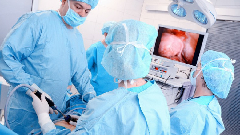 Find the Best Doctor for Laparoscopy!