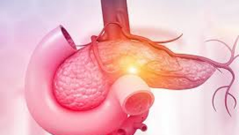 Global Exocrine Pancreatic Insufficiency Market 2022 - Top Key Players Analysis Report Till 2028