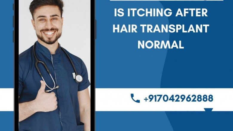 Itching After Hair Transplant Normal