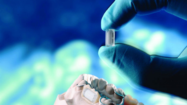 Micro-Electronic Medical Implants Market Share, Revenue and Growth Analysis Report Till 2028 | Value Market Research