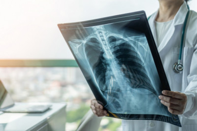 An X-Ray, Also Known As Radiography, Produces Images Of The Internal Structures Of The Body By Using Ionizing Radiation