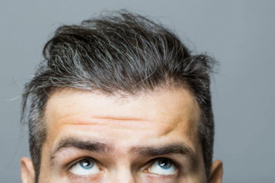 Examine This Report on Hair Loss Solution