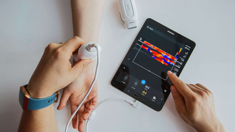 Things to know about Portable Diagnostic Device