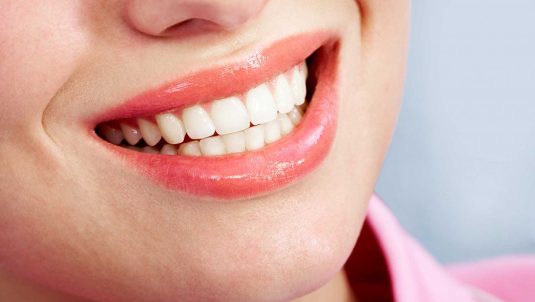 What Are The Home Remedies For Teeth Whitening?