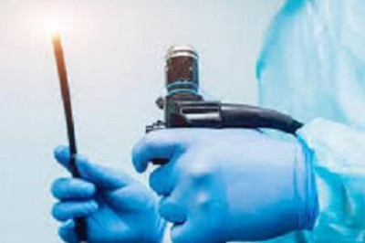 Endoscopy Equipment and Software Market: Endoscopy Equipment and Software To Grow at 6.2% CAGR During 2021-2028