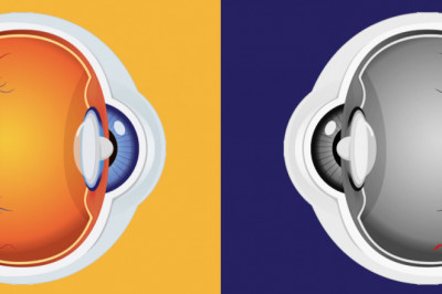 Macular Edema Treatment Is Very Effective At Reducing The Fluid In The Retina And Improving Vision