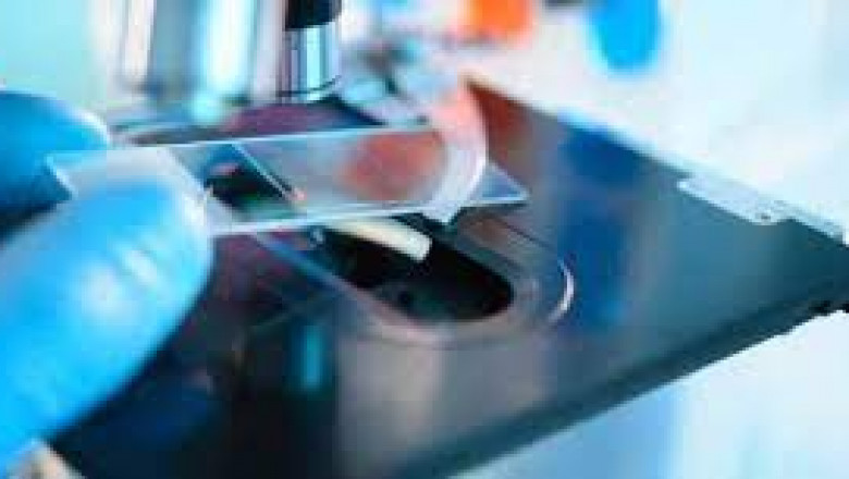Global Hospital Acquired Disease Testing Market Report, Latest Trends, Industry Opportunity & Forecast to 2028