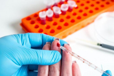 The Microscopic Evaluation of Blood Using Blood Films has been the Cornerstone of Malaria Diagnostics