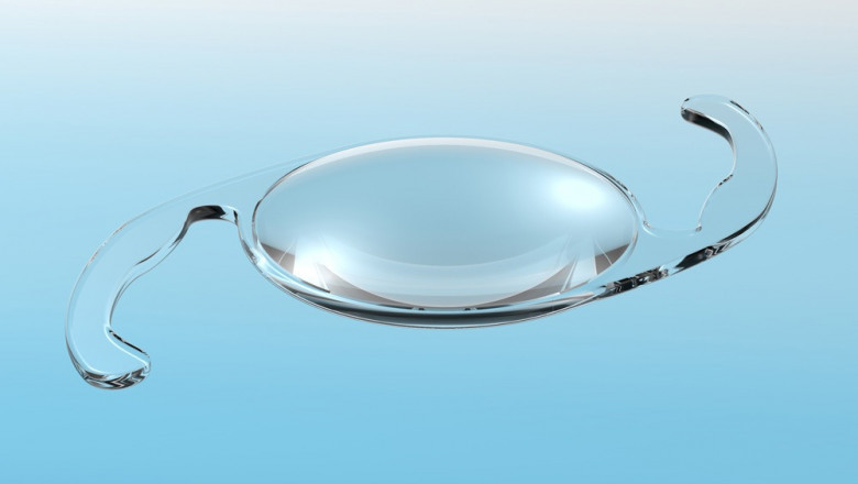 Intraocular Lens Implants Are Artificial Replacements For The Lenses Of The Eyes, Used To Correct Cataracts